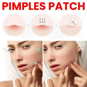 Invisible Acne Colorful Removal Skin Care Stickers for Face Spot Beauty Makeup Tools