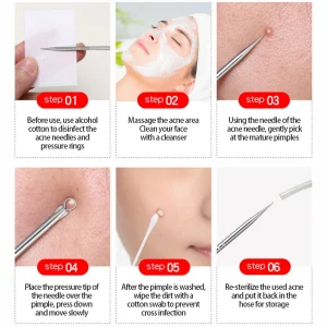 Double Head Acne Remover Needle with Stainless Steel Round and Sharp Point for Effective Blackhead and Whitehead Extraction and Pimple Squeeze